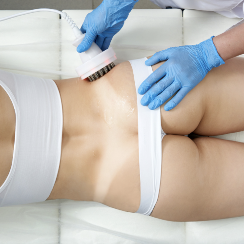 radio frequency treatment illustration